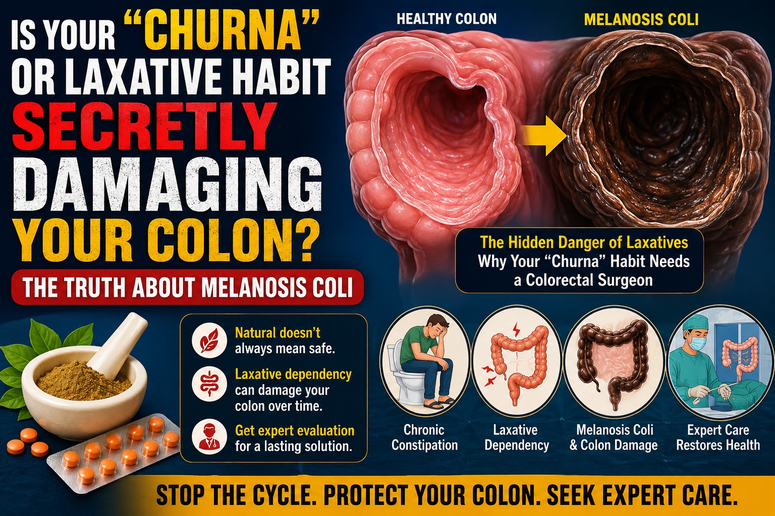 Is Your “Churna” or Laxative Habit Secretly Damaging Your Colon? The Truth About Melanosis Coli