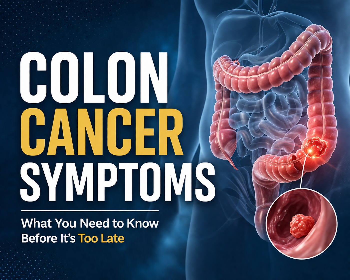 Colon Cancer Symptoms: Everything You Need to Know Before It’s Too Late